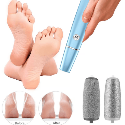 FootRenew™ - Banish Painful Calluses With Professional Power And Comfort