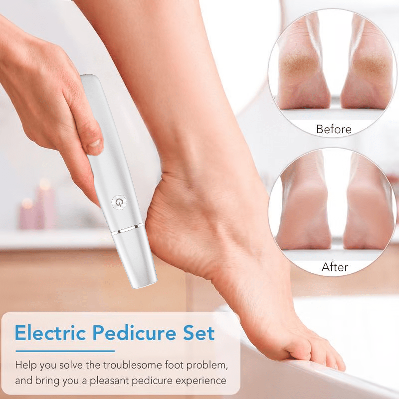 FootRenew™ - Banish Painful Calluses With Professional Power And Comfort