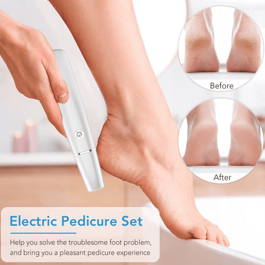 FootRenew™ - Banish Painful Calluses With Professional Power And Comfort
