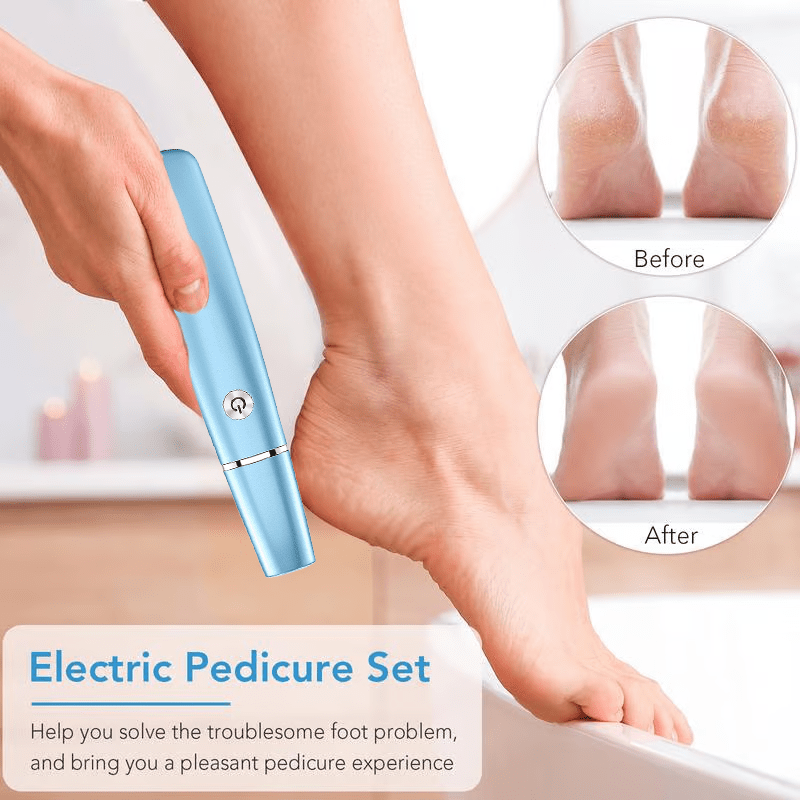 FootRenew™ - Banish Painful Calluses With Professional Power And Comfort