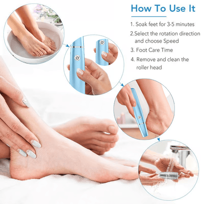 FootRenew™ - Banish Painful Calluses With Professional Power And Comfort