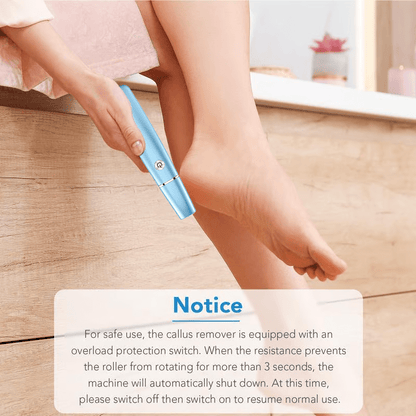 FootRenew™ - Banish Painful Calluses With Professional Power And Comfort