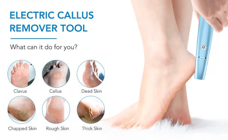 FootRenew™ - Banish Painful Calluses With Professional Power And Comfort