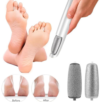 FootRenew™ - Banish Painful Calluses With Professional Power And Comfort