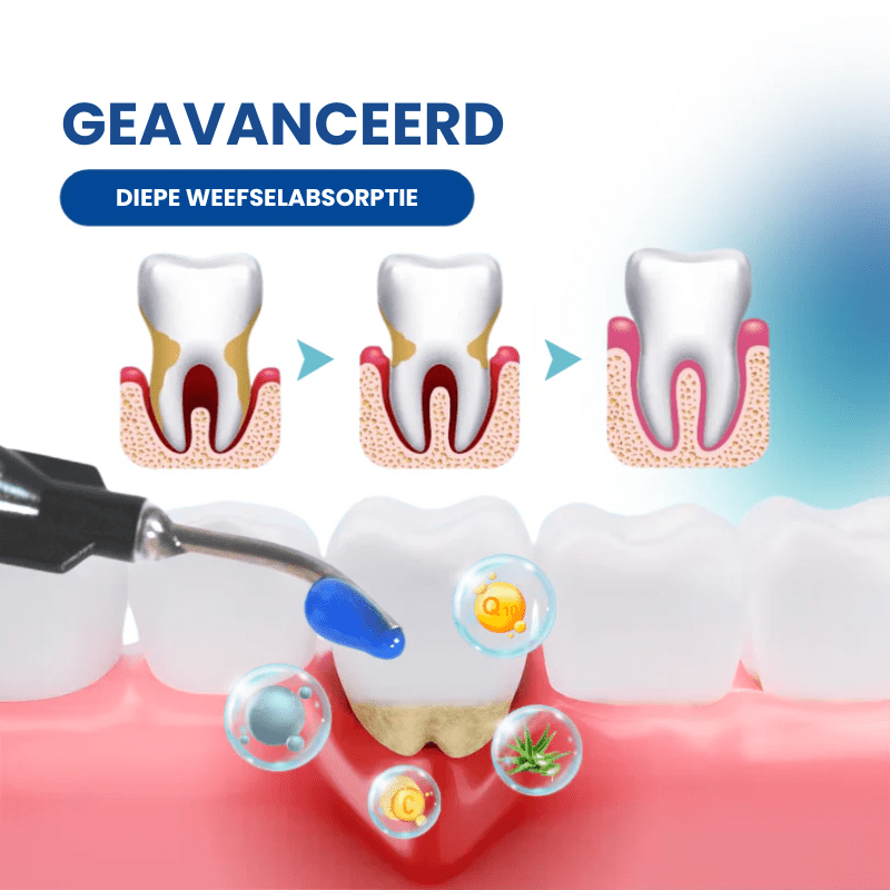 DENTAL GUARD™ – Naturally Restore Years of Gum Damage