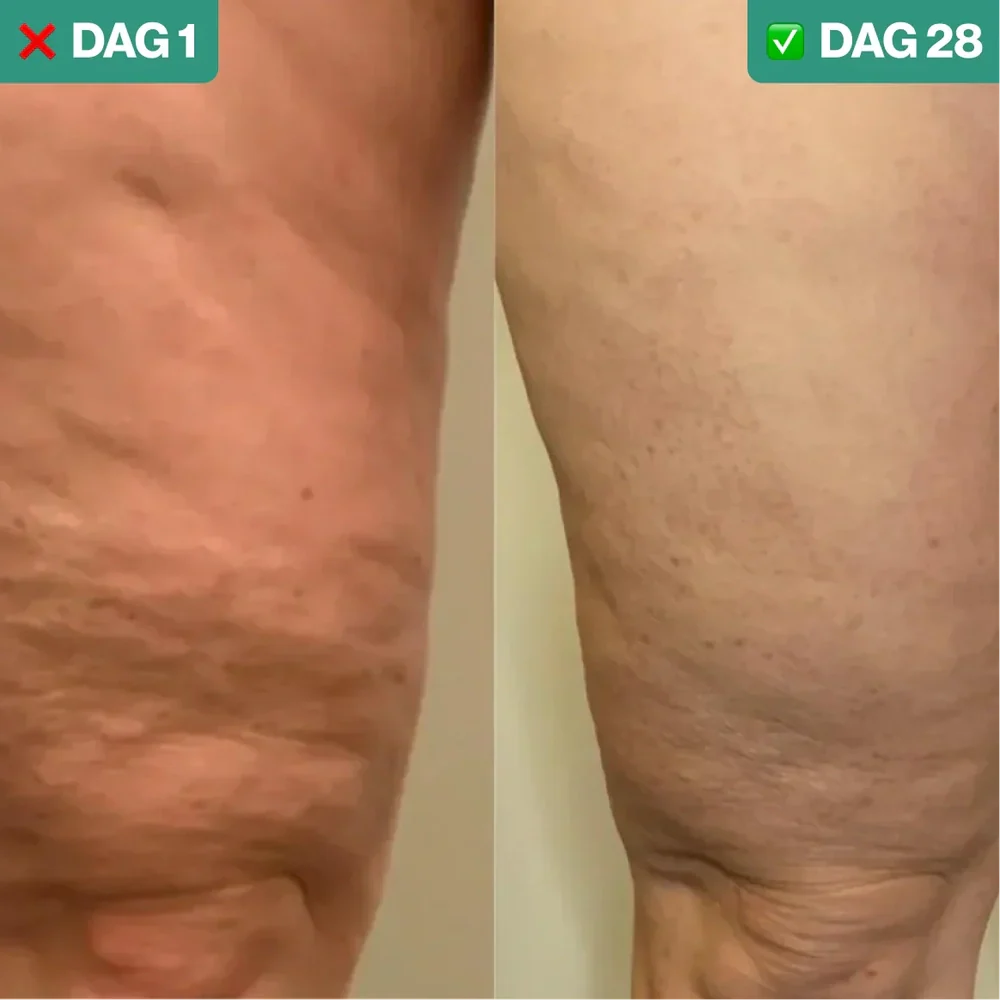 SilkLift™ – For silky-smooth, firm skin.